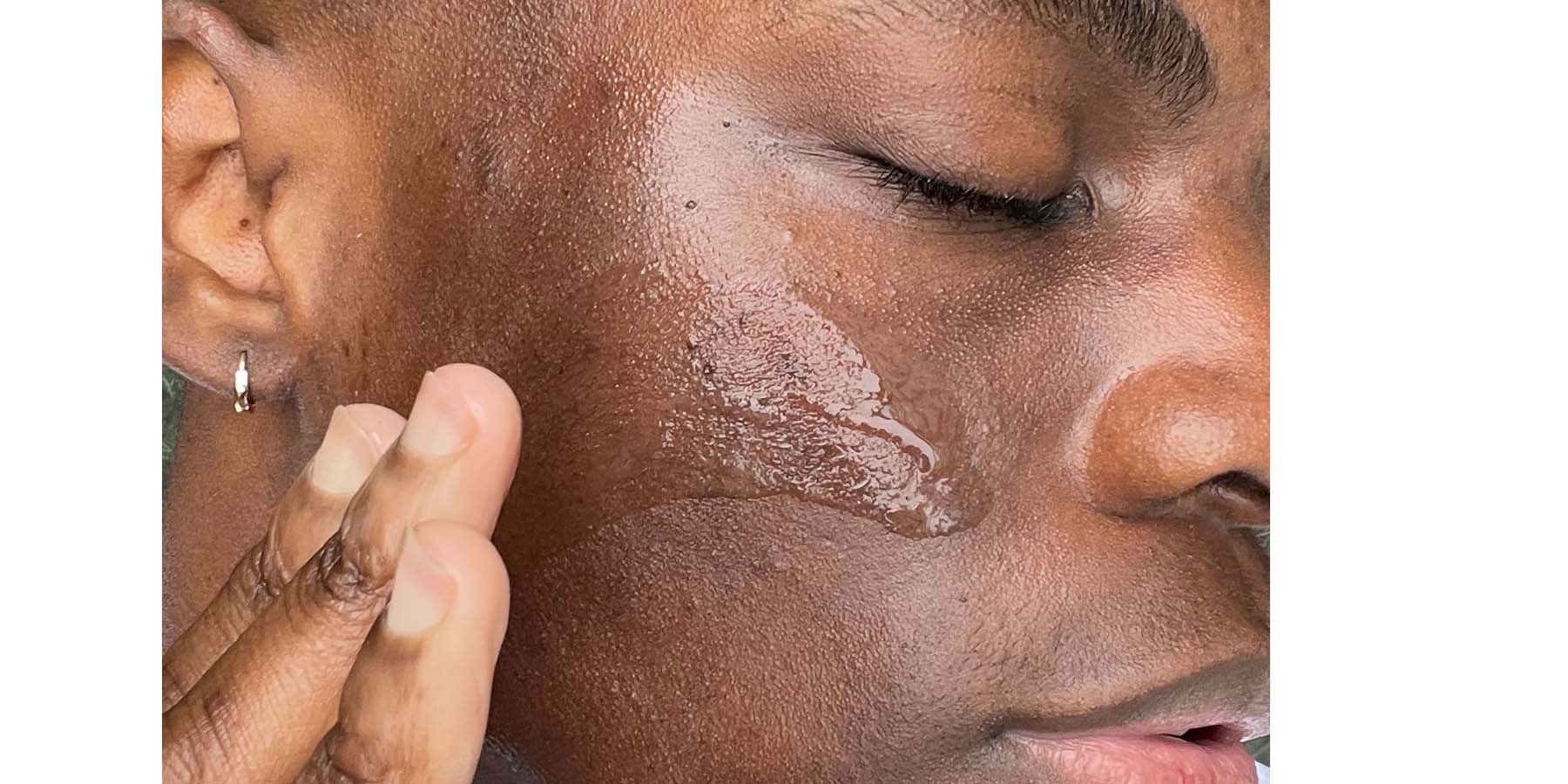 What is skin flooding?